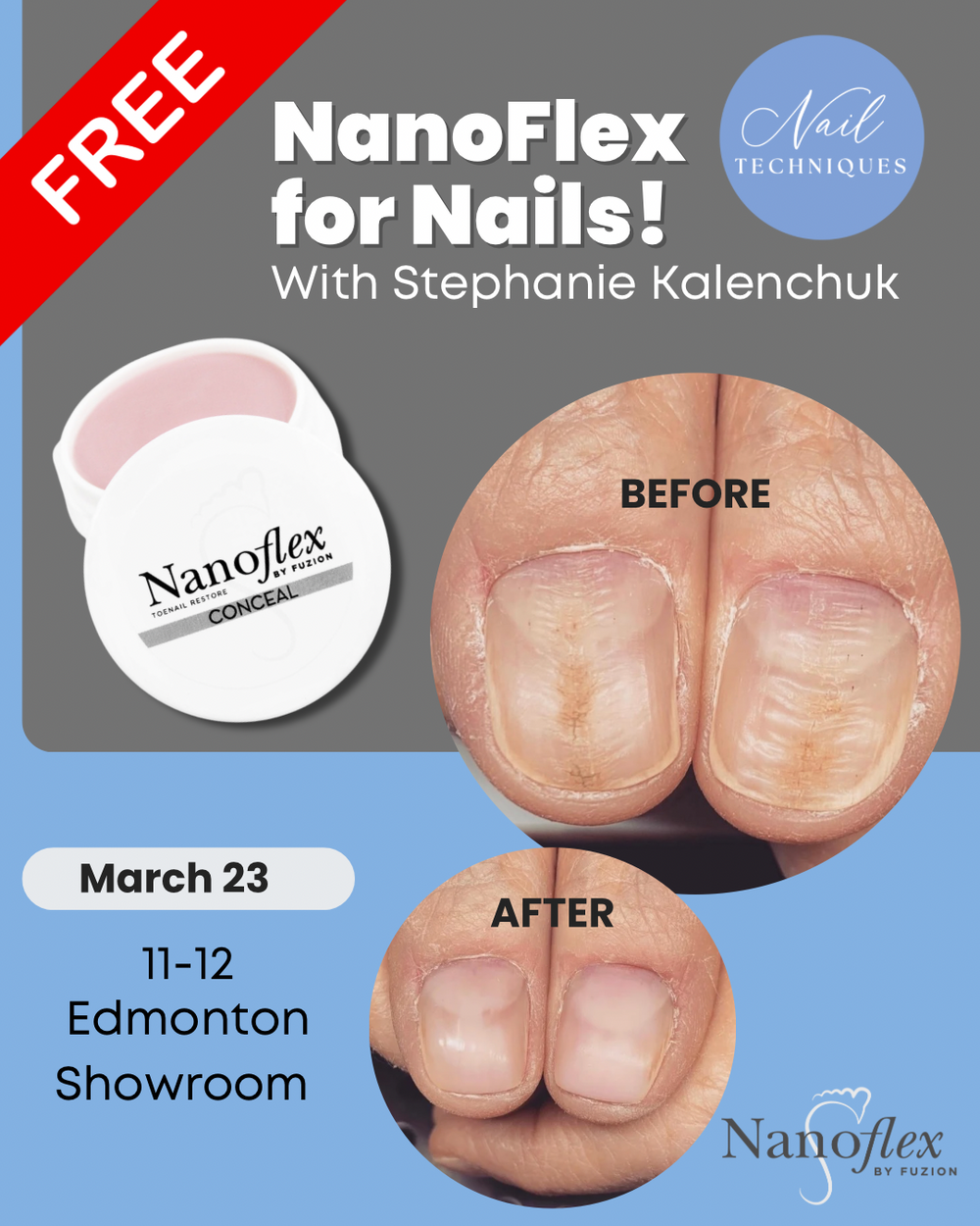 NanoFlex for Fingernail Damage | Free Workshop March 23rd